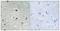 Abl1 Polyclonal Antibody